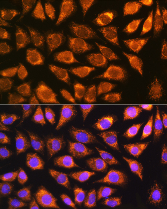 Immunofluorescence analysis of L929 cells using NDUFS5 Polyclonal Antibody at dilution of 1:100 (40x lens). Blue: DAPI for nuclear staining.