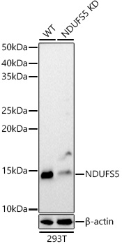 Western blot analysis of extracts from wild type(WT) and NDUFS5 knockdown (KD) 293T cells, using NDUFS5 Polyclonal Antibody at 1:1000 dilution.