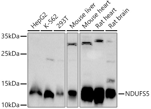 Western blot analysis of extracts of various cell lines using NDUFS5 Polyclonal Antibody at 1:1000 dilution.