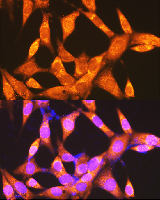Immunofluorescence analysis of NIH-3T3 cells using PEPCK/PEPCK/PCK2 Polyclonal Antibody at dilution of 1:100 (40x lens). Blue: DAPI for nuclear staining.