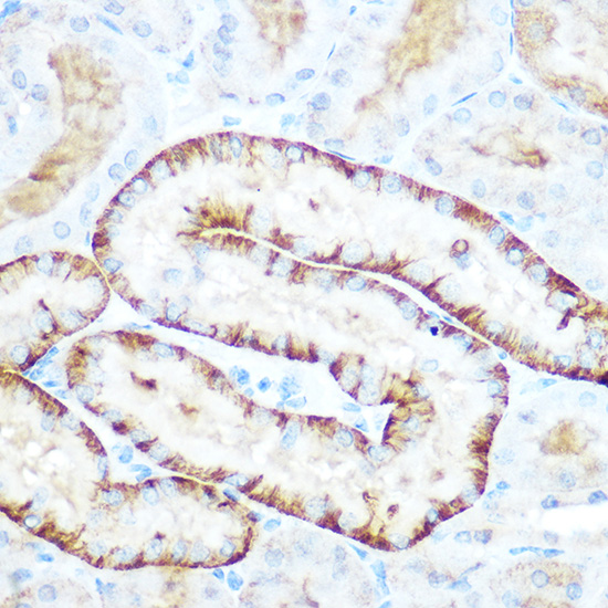 Immunohistochemistry of paraffin-embedded mouse kidney using PEPCK/PEPCK/PCK2 Polyclonal Antibody at dilution of 1:100 (40x lens).Perform microwave antigen retrieval with 10 mM Tris/EDTA buffer pH 9.0 before commencing with IHC staining protocol.