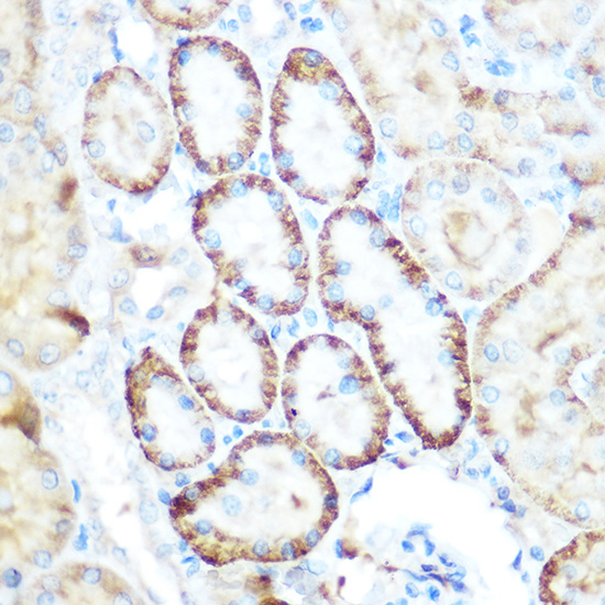 Immunohistochemistry of paraffin-embedded rat kidney using PEPCK/PEPCK/PCK2 Polyclonal Antibody at dilution of 1:100 (40x lens).Perform microwave antigen retrieval with 10 mM Tris/EDTA buffer pH 9.0 before commencing with IHC staining protocol.