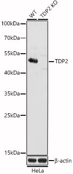 Western blot analysis of extracts from wild type(WT) and TDP2 knockout (KO) HeLa(KO) cells, using TDP2 Polyclonal Antibody at 1:3000 dilution.