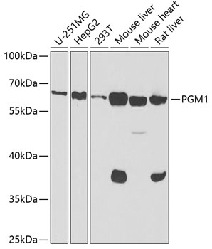 Western blot analysis of extracts of various cell lines using PGM1 Polyclonal Antibody at 1:1000 dilution.