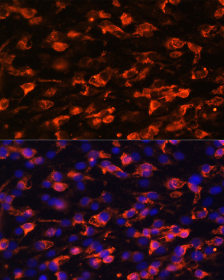 Immunofluorescence analysis of C6 cells using PIK3C2A Polyclonal Antibody at dilution of 1:100. Blue: DAPI for nuclear staining.