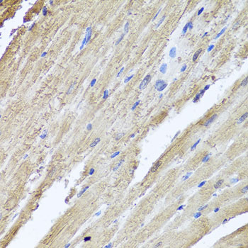 Immunohistochemistry of paraffin-embedded rat heart using PIK3C2A Polyclonal Antibody at dilution of 1:100 (40x lens).Perform microwave antigen retrieval with 10 mM PBS buffer pH 7.2 before commencing with IHC staining protocol.