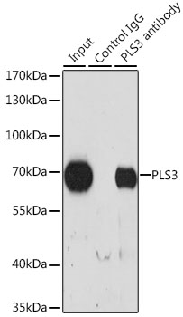 Immunoprecipitation analysis of 200ug extracts of HeLa cells using 3 ug PLS3 Polyclonal Antibody.Western blot was performed from the immunoprecipitate using PLS3 Polyclonal Antibody at a dilution of 1:1000.