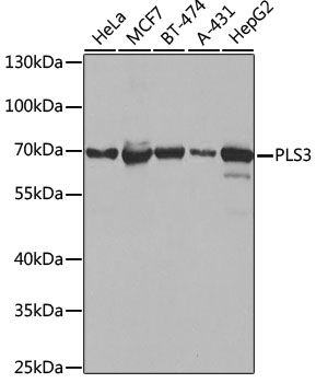 Western blot analysis of extracts of various cell lines using PLS3 Polyclonal Antibody at 1:1000 dilution.