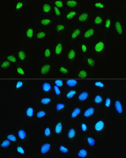 Immunofluorescence analysis of U2OS cells using CHRAC1 Polyclonal Antibody at dilution of 1:100. Blue: DAPI for nuclear staining.