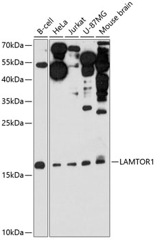 Western blot analysis of extracts of various cell lines using LAMTOR1 Polyclonal Antibody at 1:3000 dilution.