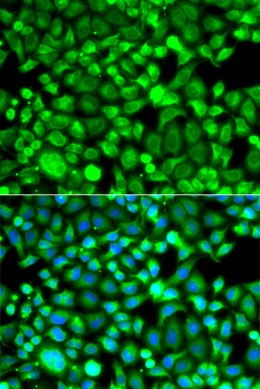 Immunofluorescence analysis of A549 cells using PSMB8 Polyclonal Antibody