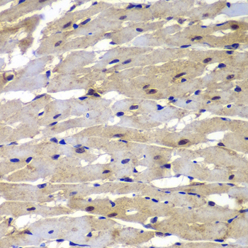 Immunohistochemistry of paraffin-embedded rat heart using PSMB8 Polyclonal Antibody at dilution of 1:100 (40x lens).Perform microwave antigen retrieval with 10 mM PBS buffer pH 7.2 before commencing with IHC staining protocol.