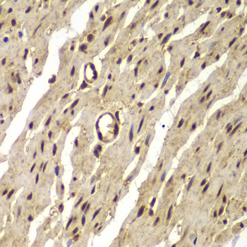 Immunohistochemistry of paraffin-embedded human colon using PSMB8 Polyclonal Antibody at dilution of 1:100 (40x lens).Perform microwave antigen retrieval with 10 mM PBS buffer pH 7.2 before commencing with IHC staining protocol.