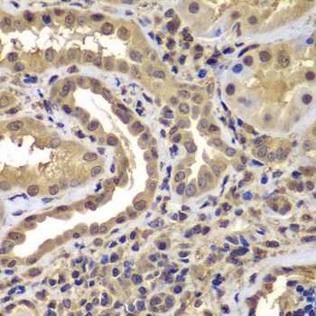 Immunohistochemistry of paraffin-embedded human kidney using PSMB8 Polyclonal Antibody at dilution of 1:100 (40x lens).Perform microwave antigen retrieval with 10 mM PBS buffer pH 7.2 before commencing with IHC staining protocol.