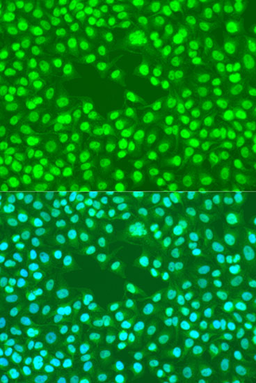 Immunofluorescence analysis of U2OS cells using Rad23B Polyclonal Antibody at dilution of 1:100. Blue: DAPI for nuclear staining.