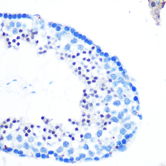 Immunohistochemistry of paraffin-embedded mouse testis using Rad23B Polyclonal Antibody at dilution of 1:100 (40x lens).Perform microwave antigen retrieval with 10 mM PBS buffer pH 7.2 before commencing with IHC staining protocol.