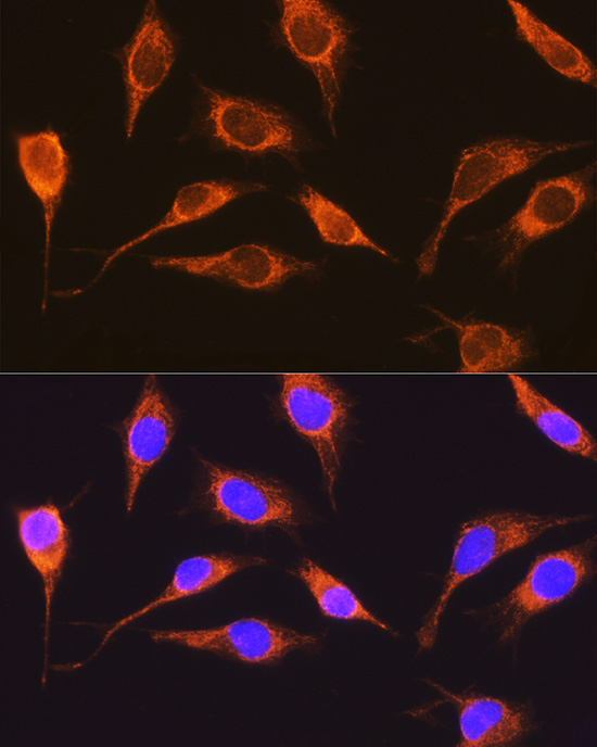 Immunofluorescence analysis of L929 cells using RCN1 Polyclonal Antibody at dilution of 1:100 (40x lens). Blue: DAPI for nuclear staining.