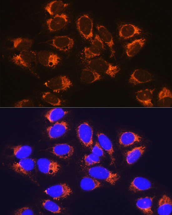 Immunofluorescence analysis of U2OS cells using RCN1 Polyclonal Antibody at dilution of 1:100 (40x lens). Blue: DAPI for nuclear staining.