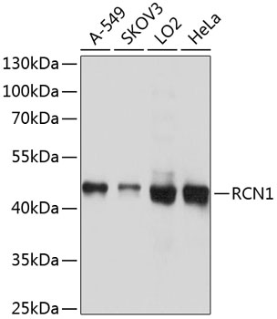 Western blot analysis of extracts of various cell lines using RCN1 Polyclonal Antibody at 1:1000 dilution.