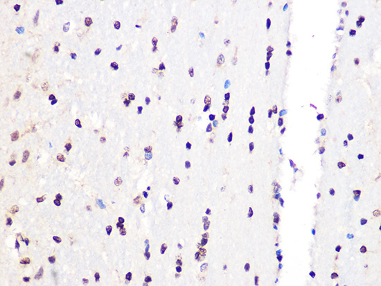 Immunohistochemistry of paraffin-embedded rat brain using PCIF1 Polyclonal Antibody at dilution of 1:100 (40x lens).Perform microwave antigen retrieval with 10 mM Tris/EDTA buffer pH 9.0 before commencing with IHC staining protocol.