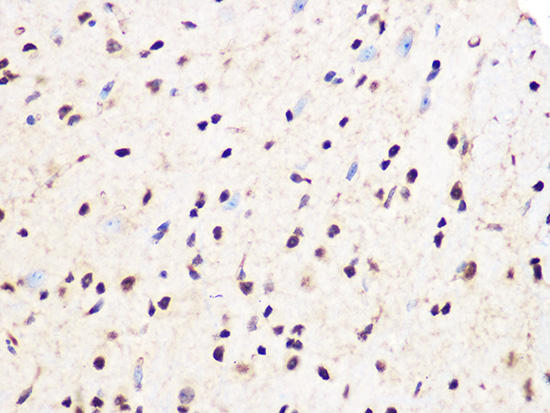 Immunohistochemistry of paraffin-embedded mouse spinal cord using PCIF1 Polyclonal Antibody at dilution of 1:100 (40x lens).Perform microwave antigen retrieval with 10 mM Tris/EDTA buffer pH 9.0 before commencing with IHC staining protocol.