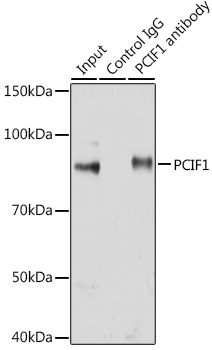 Immunoprecipitation analysis of 200ug extracts of Jurkat cells using 3ug PCIF1 Polyclonal Antibody. Western blot was performed from the immunoprecipitate using PCIF1 Polyclonal Antibody at a dilution of 1:1000.