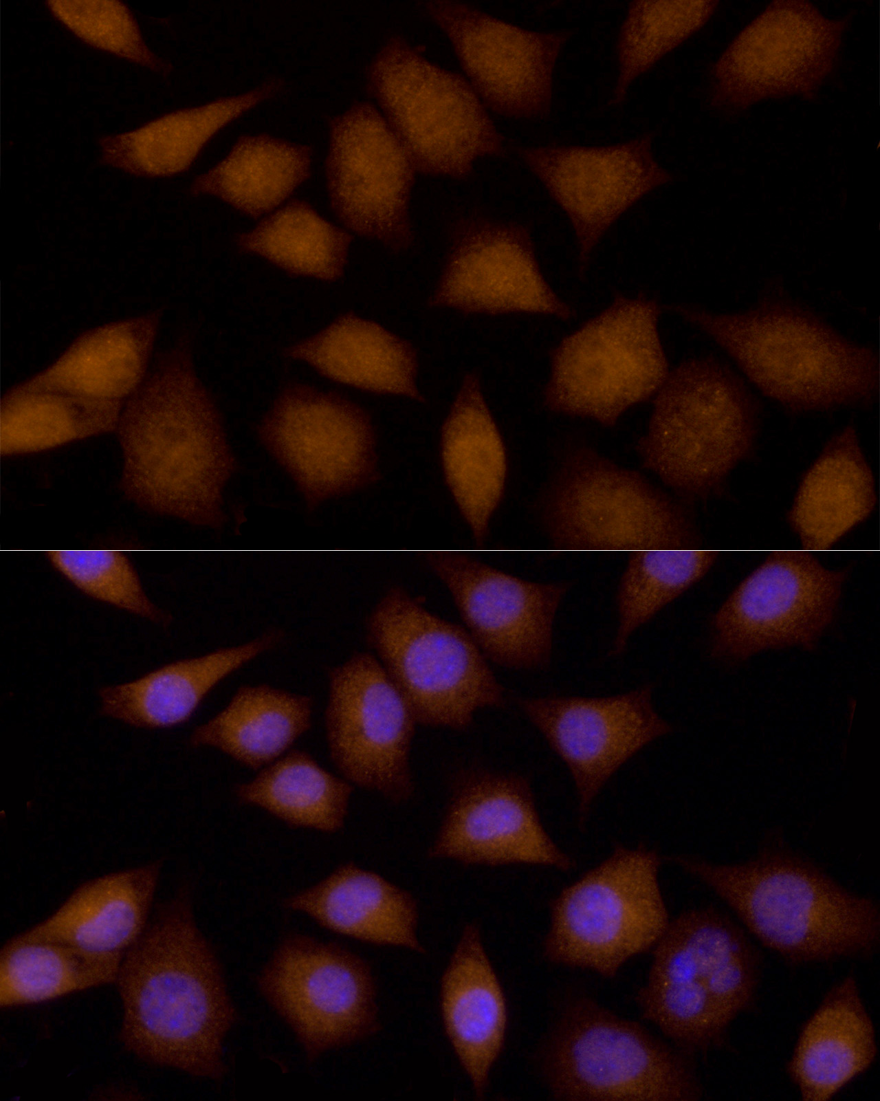 Immunofluorescence analysis of L929 cells using MAP2K4 Polyclonal Antibody at dilution of 1:100 (40x lens). Blue: DAPI for nuclear staining.