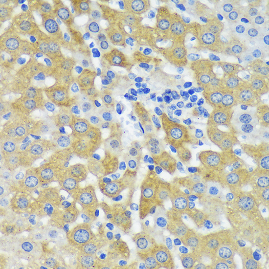 Immunohistochemistry of paraffin-embedded Mouse liver using MAP2K4 Polyclonal Antibody at dilution of 1:100 (40x lens).Perform microwave antigen retrieval with 10 mM PBS buffer pH 7.2 before commencing with IHC staining protocol.