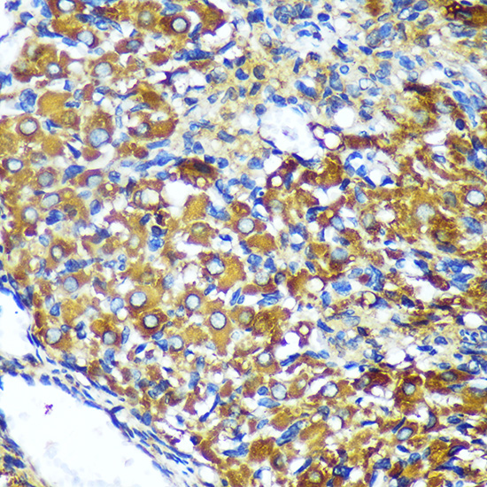 Immunohistochemistry of paraffin-embedded Rat ovary using MAP2K4 Polyclonal Antibody at dilution of 1:100 (40x lens).Perform microwave antigen retrieval with 10 mM PBS buffer pH 7.2 before commencing with IHC staining protocol.