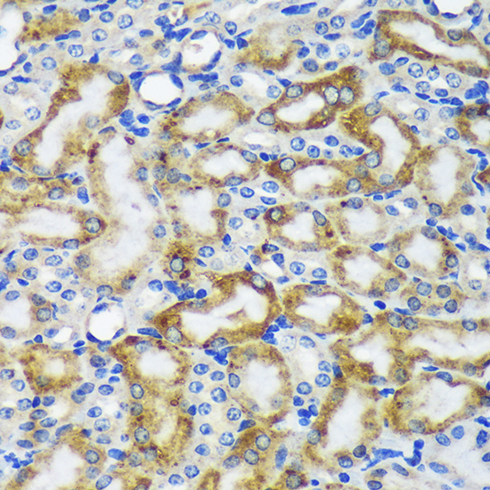 Immunohistochemistry of paraffin-embedded Mouse kidney using MAP2K4 Polyclonal Antibody at dilution of 1:100 (40x lens).Perform microwave antigen retrieval with 10 mM PBS buffer pH 7.2 before commencing with IHC staining protocol.