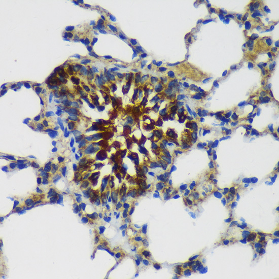 Immunohistochemistry of paraffin-embedded Rat lung using MAP2K4 Polyclonal Antibody at dilution of 1:100 (40x lens).Perform microwave antigen retrieval with 10 mM PBS buffer pH 7.2 before commencing with IHC staining protocol.