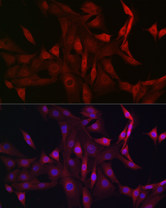 Immunofluorescence analysis of NIH/3T3 cells using STAT5B Polyclonal Antibody at dilution of 1:100 (40x lens). Blue: DAPI for nuclear staining.