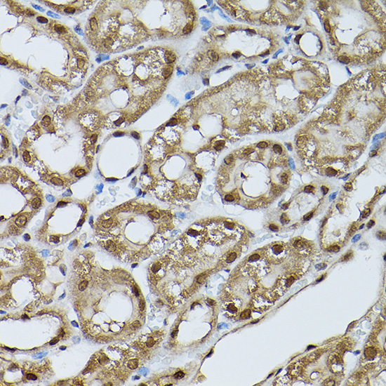 Immunohistochemistry of paraffin-embedded mouse kidney using [KO Validated] STAT5B Polyclonal Antibody at dilution of 1:100 (40x lens).Perform high pressure antigen retrieval with 10 mM citrate buffer pH 6.0 before commencing with IHC staining protocol.