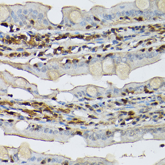 Immunohistochemistry of paraffin-embedded rat intestine using [KO Validated] STAT5B Polyclonal Antibody at dilution of 1:100 (40x lens).Perform high pressure antigen retrieval with 10 mM citrate buffer pH 6.0 before commencing with IHC staining protocol.