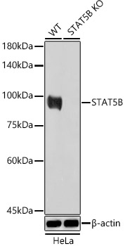 Western blot analysis of extracts from wild type(WT) and STAT5B knockout (KO) HeLa cells using STAT5B Polyclonal Antibody at 1:1000 dilution.