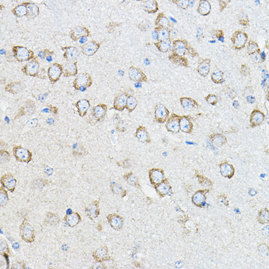 Immunohistochemistry of paraffin-embedded mouse brain using STIM1 Polyclonal Antibody atdilution of 1:100 (40x lens).Perform microwave antigen retrieval with 10 mM PBS buffer pH 7.2 before commencing with IHC staining protocol.