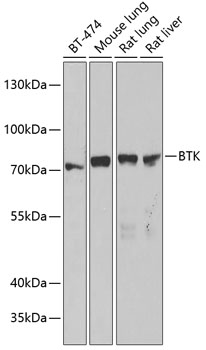 Western blot analysis of extracts of various cell lines using BTK Polyclonal Antibody at 1:1000 dilution.