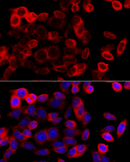 Immunofluorescence analysis of HeLa cells using Grp94 Polyclonal Antibody at dilution of 1:100 (40x lens). Blue: DAPI for nuclear staining.