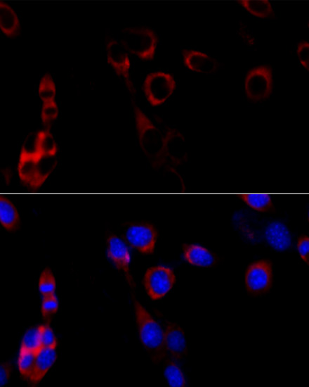 Immunofluorescence analysis of NIH/3T3 cells using Grp94 Polyclonal Antibody at dilution of 1:100 (40x lens). Blue: DAPI for nuclear staining.