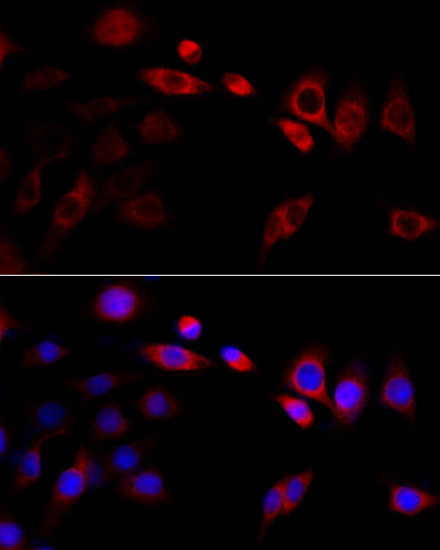 Immunofluorescence analysis of PC-12 cells using Grp94 Polyclonal Antibody at dilution of 1:100 (40x lens). Blue: DAPI for nuclear staining.