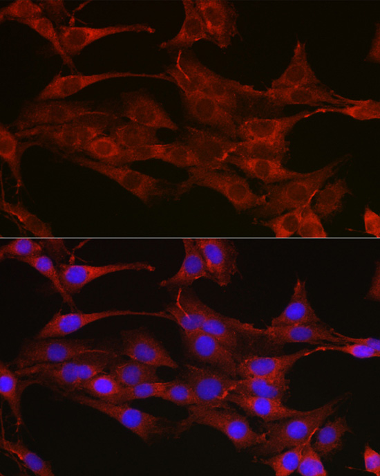 Immunofluorescence analysis of C6 cells using TYMS Polyclonal Antibody at dilution of 1:100 (40x lens). Blue: DAPI for nuclear staining.