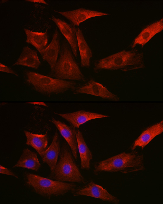 Immunofluorescence analysis of NIH-3T3 cells using TYMS Polyclonal Antibody at dilution of 1:100 (40x lens). Blue: DAPI for nuclear staining.