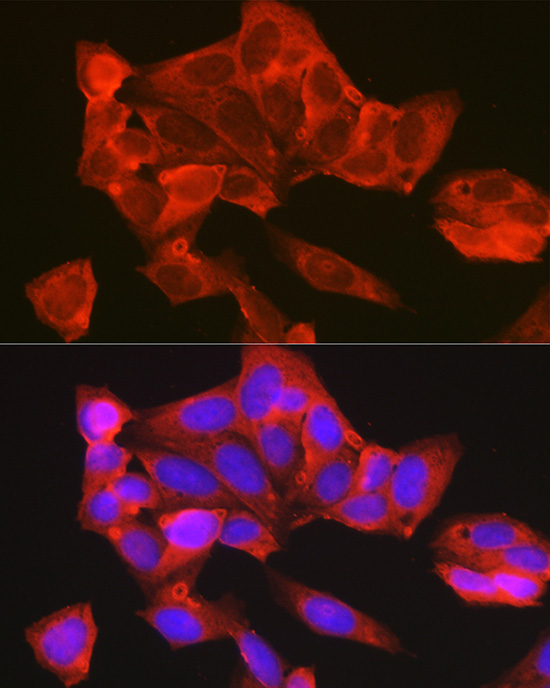 Immunofluorescence analysis of U2OS cells using TYMS Polyclonal Antibody at dilution of 1:100 (40x lens). Blue: DAPI for nuclear staining.