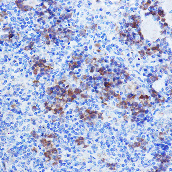 Immunohistochemistry of paraffin-embedded mouse spleen using TYMS Polyclonal Antibody at dilution of 1:100 (40x lens).Perform high pressure antigen retrieval with 10 mM citrate buffer pH 6.0 before commencing with IHC staining protocol.