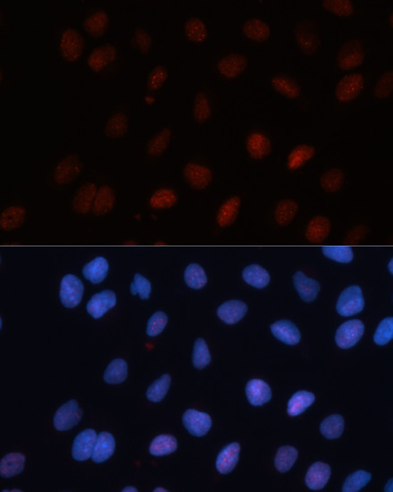 Immunofluorescence analysis of U2OS cells using SUMO1 Polyclonal Antibody at dilution of 1:100. Blue: DAPI for nuclear staining.