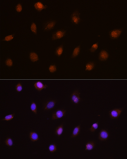 Immunofluorescence analysis of L929 cells using USP4 Polyclonal Antibody at dilution of 1:100. Blue: DAPI for nuclear staining.