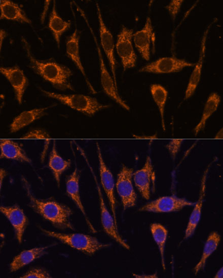 Immunofluorescence analysis of L929 cells using CCDC6 Polyclonal Antibody at dilution of 1:100. Blue: DAPI for nuclear staining.