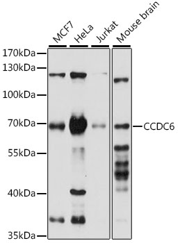 Western blot analysis of extracts of various cell lines using CCDC6 Polyclonal Antibody at 1:1000 dilution.