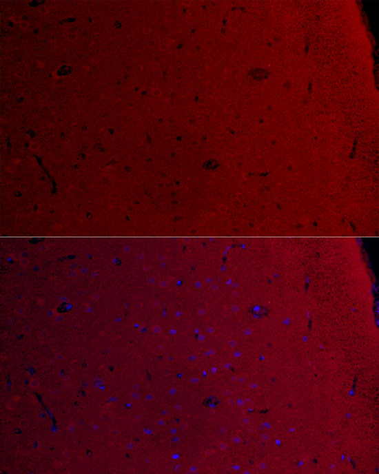 Immunofluorescence analysis of Rat brain using CAMK2G Polyclonal Antibody at dilution of 1 : 100 (40x lens). Blue: DAPI for nuclear staining.