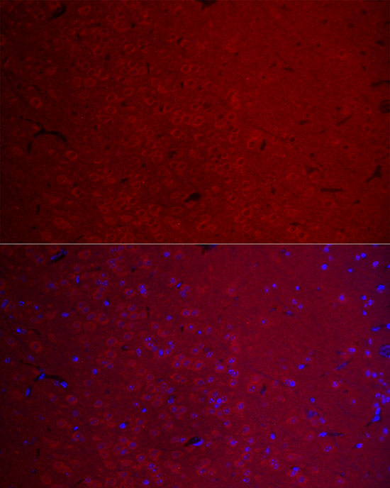 Immunofluorescence analysis of Mouse brain using CAMK2G Polyclonal Antibody at dilution of 1 : 100 (40x lens). Blue: DAPI for nuclear staining.